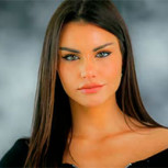 Emilia Dides mostró retoque estético en su rostro e hizo reaccionar a seguidores: Esto le dijeron