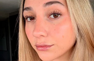 Carlita Inostroza vuelve a compartir imagen en las redes tras cirug&iacute;a est&eacute;tica sacando elogios de sus fan&aacute;ticos