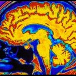 Estudio revela que el cerebro humano disfruta al ver sufrir a sus enemigos