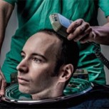Científicos anuncian primer trasplante de cabeza de la historia: ¿Verdad o error comunicacional?