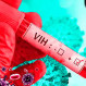VIH y Sida: ¿Cómo enfrentar estas dos graves enfermedades