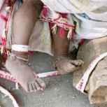 Padres atan a bebé de 15 meses a una piedra para salir a trabajar: Impacto por imagen