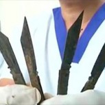 Médicos extraen 40 cuchillos del estómago de un hombre en India: Impacto por dramático caso