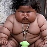 Chahat: La bebé gigante de India que pesa 17 kilos y come como una niña de 10 años