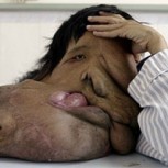 Las enfermedades más extrañas del mundo: Impactantes casos y fotografías