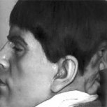 Edward Mordrake: La escalofriante historia del hombre de la cara “maldita”