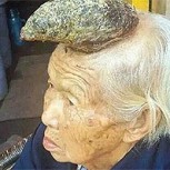 La “mujer unicornio”: Extraño caso sin explicación de malformación en la cabeza