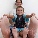 Nuevo récord: venezolano con los pies más grandes del mundo