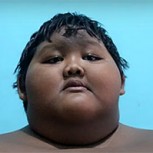 Conoce a Arya Permana, el niño más obeso del mundo: Tiene 10 años y pesa 192 kilos