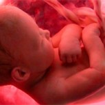 Nace un bebé ‘embarazado’ de su gemelo: Extraño caso requirió explicación médica