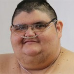 Conoce a Juan Pedro Franco: El hombre más obeso del mundo que llegó a pesar 595 kilos