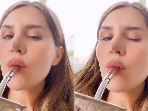 mica tinelli complicacion cirugia de nariz