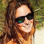 Kel Calderón: Conocido cirujano plástico reveló que se negó a operarla