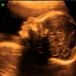 Madre vio a su bebé antes de nacer en una ecografía en la misma postura que tenía su abuelo: Increíbles fotografías