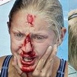 Ranking extremo: 20 fotos de los peores porrazos o golpes de los deportistas