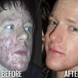 Antes y después: 15 nerds cuando chicos que hoy deslumbran con su look de adultos
