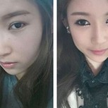 Fotos del antes y después: Impresionantes cirugías plásticas que se realizan en Corea del Sur