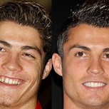 Fotos de dentaduras de famosos: Antes y después que pueden marcar una gran diferencia