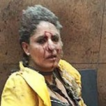 Atentados Bruselas: Fotos impactantes de los dramáticos momentos de los ataques