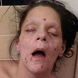 Fotos de la madre “zombie” por la heroína: Dramático “antes y después” de la rehabilitación