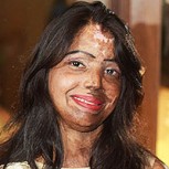 “Las cicatrices del horror”: Fotos de 9 mujeres desfiguradas por brutales ataques con ácido
