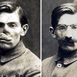 Fotos: El sobrecogedor caso de los desfigurados de la guerra y cómo una mujer les cambió radicalmente la vida