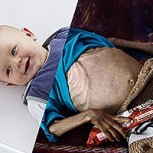 Fotos muestran las dos caras del mundo: Desgarradores registros de las diferencias que existen