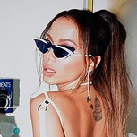 Anitta y las fotos al estilo “antes y después” que la muestran irreconocible antes de las cirugías