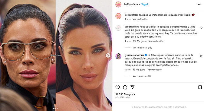 Belleza Falsa Fotos De La Cuenta De Instagram Que Muestra El Antes Y Despu S De Los