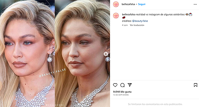 Belleza falsa Fotos de la cuenta de Instagram que muestra el antes y después de los