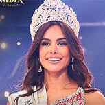 Miss Colombia 2025: Su comentado “antes y después” de las cirugías