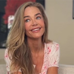 Denise Richards muestra el impactante “antes y después” tras rejuvenecimiento facial