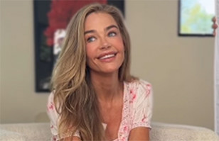 Denise Richards muestra el impactante &ldquo;antes y despu&eacute;s&rdquo; tras rejuvenecimiento facial