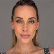 Últimas fotos de la pareja de Benjamín Vicuña: Así luce Anita Espasandin en las redes
