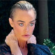 Denise Richards se somete a cirugía y los resultados del cambio sorprenden