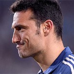 Lionel Scaloni sufrió un accidente de tránsito y fue hospitalizado por las lesiones