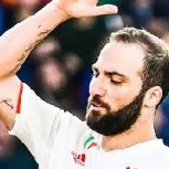 Higuaín terminó hospitalizado luego de recibir un tremendo golpe en el rostro en partido de la Juve