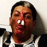 Hinchas brasileños protagonizan vergonzosa pelea con palos y disparos