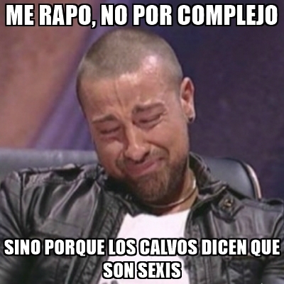 hombres calvos 10
