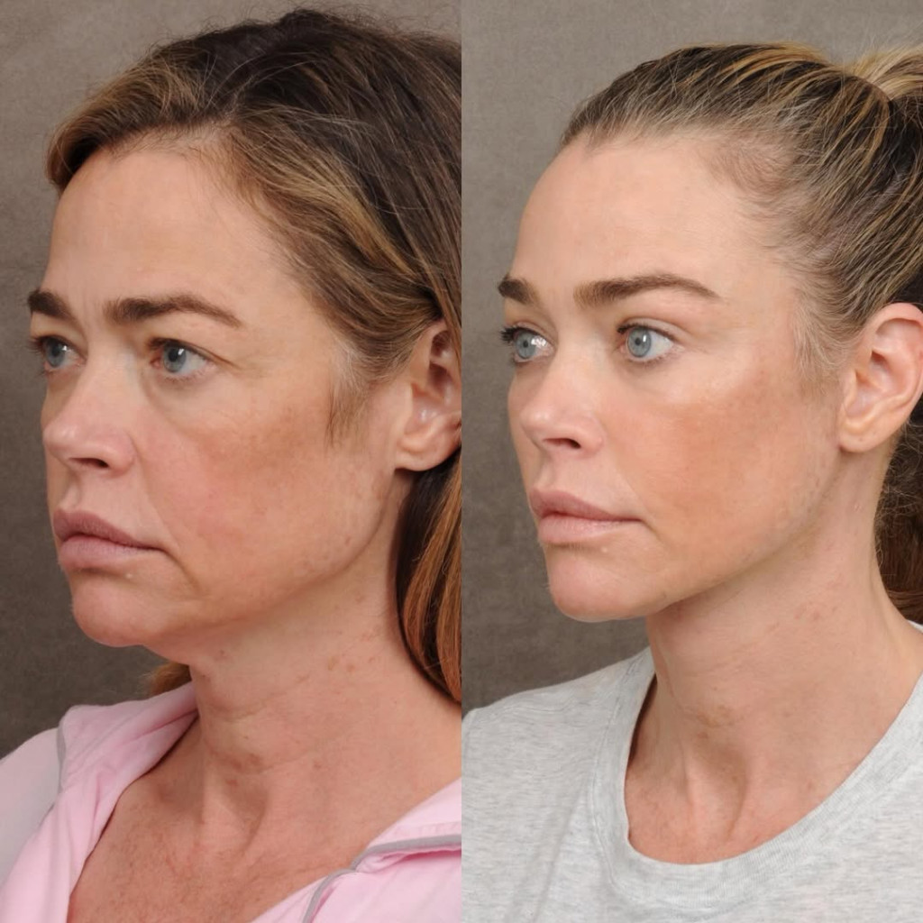 denise richards