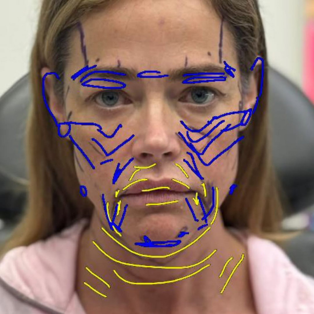 denise richards 2