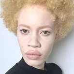Modelo albina acapara la atención en el mundo publicitario: Protagoniza campaña de maquillaje y triunfa en pasarelas