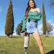 Perdió una pierna en un asalto: La inspiradora historia de una modelo que llegó a la televisión española