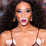 Winnie Harlow, icónica modelo emblema de resiliencia, posó junto a su figura de cera en el Día Mundial del Vitiligo