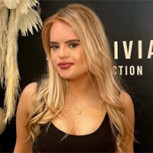 Kate Grant, primera modelo con síndrome de Down de Reino Unido, crea conciencia sobre la igualdad