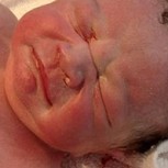 Bebé nace sosteniendo desafiante en su mano el dispositivo intrauterino de su madre