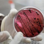 Preocupación en Bolivia: Descubren mortal virus similar al Ébola