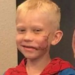 “The Avengers” mandaron mensajes de respeto a niño que salvó a su hermana de brutal ataque de un perro