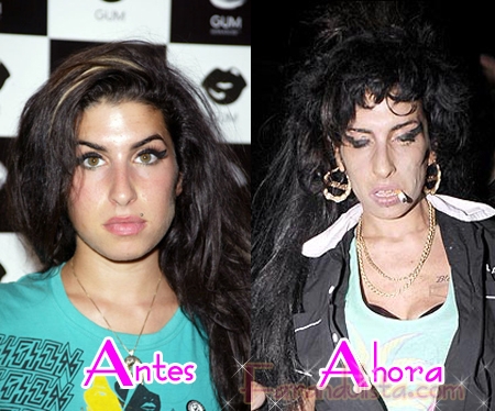 amy-before-after