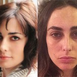 Instagram se llenó de fotos de mujeres sin maquillaje: La belleza más honesta de todas